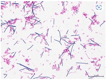 細菌検査画像（グラム染色・抗酸菌染色）
